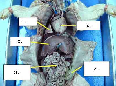 pathogenesis of leprosy